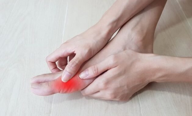 Berikut Cara Cegah Asam Urat