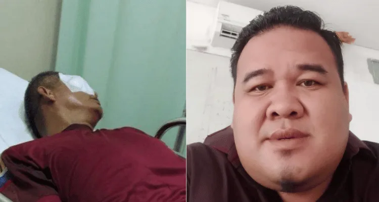Wali Murid Ketapel Mata Guru di Bengkulu, Tokoh Muda Kutuk Keras