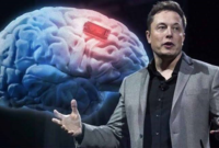 Elon Musk Siapkan Terobosan Menanam Chip di Otak Manusia
