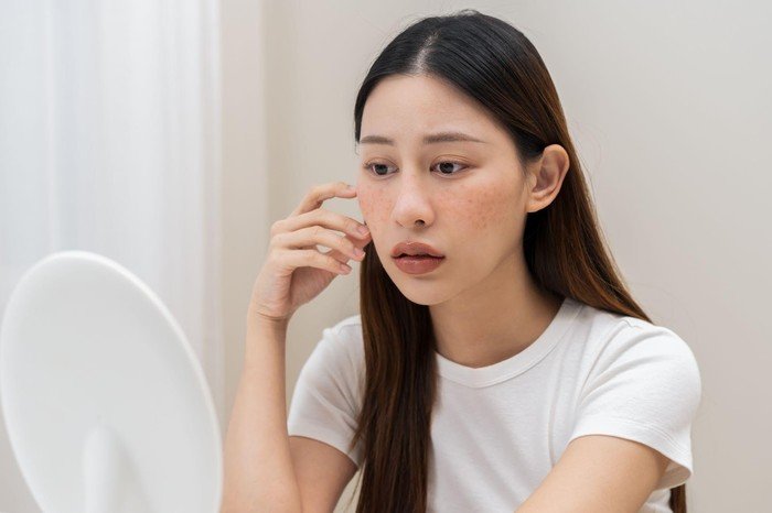 Tanda Kulit Wajah Mulai Kekurangan Kolagen, Ini Ciri-cirinya